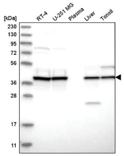 UROD Antibody, Novus Biologicals 25 &mu;L | Buy Online | Novus Biologicals | Fisher Scientific