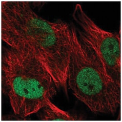 USP1 Antibody, Novus Biologicals 25 &mu;L:Antibodies, Polyclonal