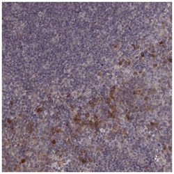 USP15 Antibody, Novus Biologicals:Antibodies:Primary Antibodies