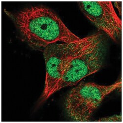 USP24 Antibody, Novus Biologicals 100&mu;L; Unlabeled:Antibodies, Polyclonal