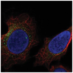 USP27X Antibody, Novus Biologicals 100&mu;L; Unlabeled:Antibodies, Polyclonal