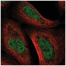 UVSSA Antibody, Novus Biologicals:Antibodies:Primary Antibodies