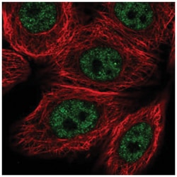 VDR/NR1I1/Vitamin D Receptor Antibody, Novus Biologicals:Antibodies:Primary