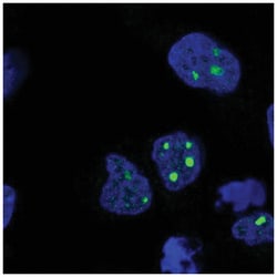 VEST1 Antibody, Novus Biologicals 25 &mu;L:Antibodies, Polyclonal