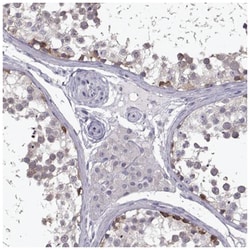 VGF Antibody, Novus Biologicals 100 &mu;L | Buy Online | Novus Biologicals | Fisher Scientific