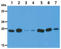 VHR/DUSP3 Mouse anti-Human, Clone: 9.00E+06, Novus Biologicals 100 &mu;L | Buy Online | Novus Biologicals | Fisher Scientific