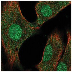 VHR/DUSP3 Antibody, Novus Biologicals:Antibodies:Primary Antibodies