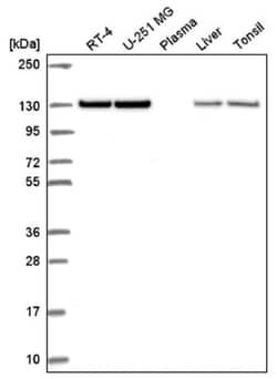 Vinculin Antibody, Novus Biologicals 100&mu;L; Unlabeled:Antibodies, Polyclonal