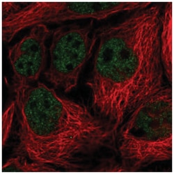 Vinexin Antibody, Novus Biologicals 100&mu;L; Unlabeled:Antibodies, Polyclonal