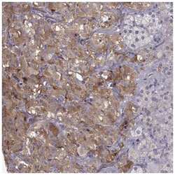 VMAT1/SLC18A1 Antibody, Novus Biologicals 100 &mu;L | Buy Online | Novus Biologicals | Fisher Scientific