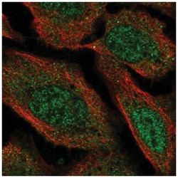 VPS13D Antibody, Novus Biologicals 100&mu;L; Unlabeled:Antibodies, Polyclonal