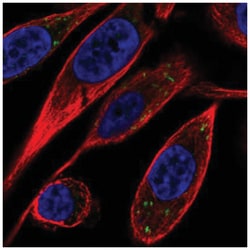 VTI1B Antibody, Novus Biologicals 100 &mu;L | Buy Online | Novus Biologicals | Fisher Scientific