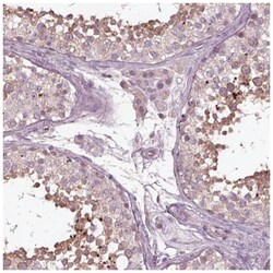 VWA5B1 Antibody, Novus Biologicals 100&mu;L; Unlabeled:Antibodies, Polyclonal