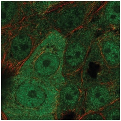WBP2 Antibody, Novus Biologicals 25 &mu;L, Unlabeled:Antibodies, Polyclonal