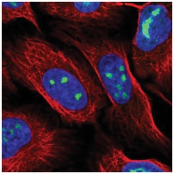 WDR3 Antibody, Novus Biologicals 100&mu;L; Unlabeled:Antibodies, Polyclonal