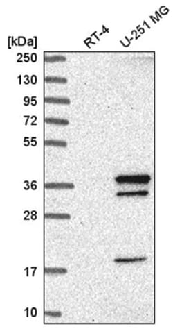 WDR82 Antibody, Novus Biologicals 100&mu;L; Unlabeled:Antibodies, Polyclonal
