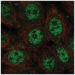 wdyhv1 Antibody, Novus Biologicals 25 &mu;L, Unlabeled:Antibodies, Polyclonal