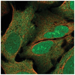 WIBG Antibody, Novus Biologicals 25 &mu;L, Unlabeled:Antibodies, Polyclonal