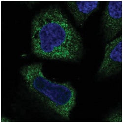 WISP3 Antibody, Novus Biologicals 25 &mu;L:Antibodies, Polyclonal