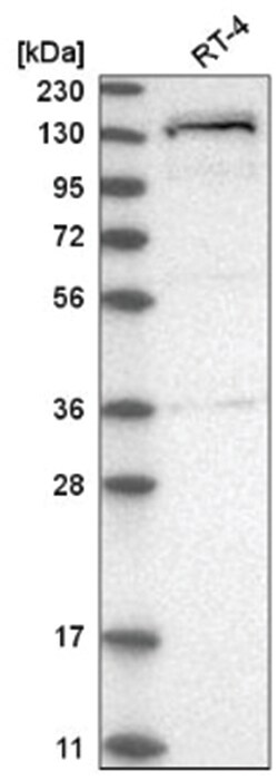 WIZ Antibody, Novus Biologicals 100 &mu;L | Buy Online | Novus Biologicals | Fisher Scientific