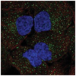 WNK3 Antibody, Novus Biologicals 25 &mu;L, Unlabeled:Antibodies, Polyclonal