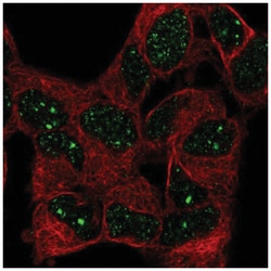 WSTF Antibody, Novus Biologicals 100μL; Unlabeled:Antibodies, Polyclonal