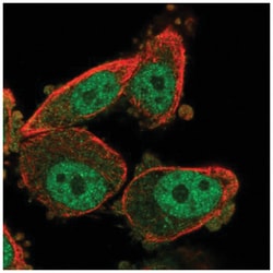 WT1 Antibody, Novus Biologicals:Antibodies:Primary Antibodies
