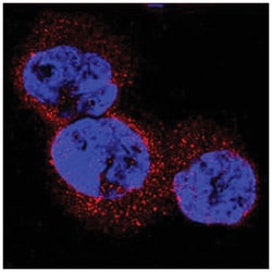 WT1 Antibody (960522), Novus Biologicals 25ug; Unlabeled:Antibodies, Monoclonal
