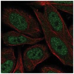 XPD Antibody, Novus Biologicals:Antibodies:Primary Antibodies