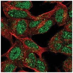 XRCC2 Antibody, Novus Biologicals:Antibodies:Primary Antibodies