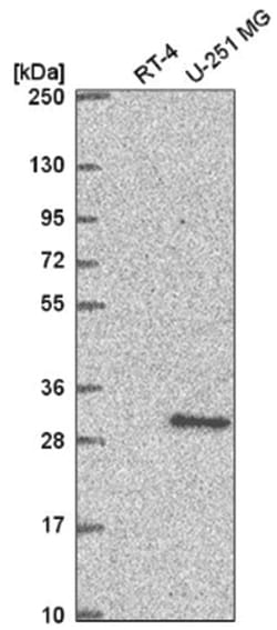XRCC3 Antibody, Novus Biologicals:Antibodies:Primary Antibodies