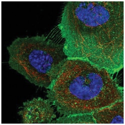 XRCC6BP1 Antibody, Novus Biologicals 100&mu;L; Unlabeled:Antibodies, Polyclonal