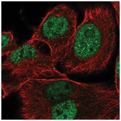 XRRA1 Antibody, Novus Biologicals 100&mu;L; Unlabeled:Antibodies, Polyclonal