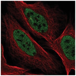 YdjC Homolog (Bacterial) Antibody, Novus Biologicals 100&mu;L; Unlabeled:Antibodies,