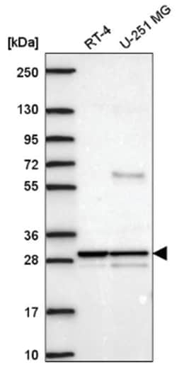 YIPF5 Antibody, Novus Biologicals 25 &mu;L, Unlabeled:Antibodies, Polyclonal