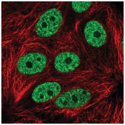 YLPM1 Antibody, Novus Biologicals 100&mu;L; Unlabeled:Antibodies, Polyclonal