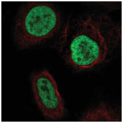 YTHDC2 Antibody, Novus Biologicals 100&mu;L; Unlabeled:Antibodies, Polyclonal