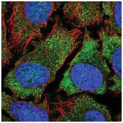 YTHDF2 Antibody, Novus Biologicals 100&mu;L; Unlabeled:Antibodies, Polyclonal
