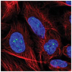 YY1AP1 Antibody, Novus Biologicals 25 &mu;L, Unlabeled:Antibodies, Polyclonal