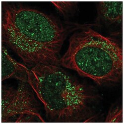 ZADH2 Antibody, Novus Biologicals:Antibodies:Primary Antibodies