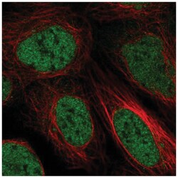ZBTB10 Antibody, Novus Biologicals 100&mu;L; Unlabeled:Antibodies, Polyclonal