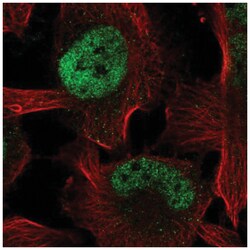 ZBTB38 Antibody, Novus Biologicals 100 &mu;L | Buy Online | Novus Biologicals | Fisher Scientific