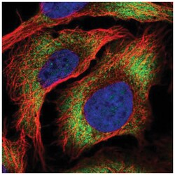 ZC3HAV1L Antibody, Novus Biologicals 100 &mu;L | Buy Online | Novus Biologicals | Fisher Scientific