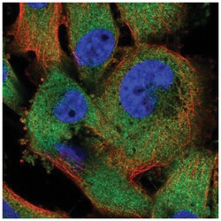 ZCCHV Antibody, Novus Biologicals 25 &mu;L:Antibodies, Polyclonal