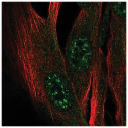 ZCWPW2 Antibody, Novus Biologicals 25 &mu;L, Unlabeled:Antibodies, Polyclonal