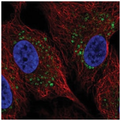 ZDHHC11 Antibody, Novus Biologicals 100&mu;L; Unlabeled:Antibodies, Polyclonal