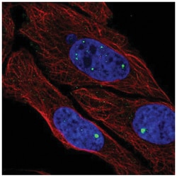 ZDHHC4 Antibody, Novus Biologicals 100&mu;L; Unlabeled:Antibodies, Polyclonal