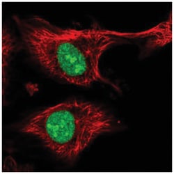 ZFP91 Antibody, Novus Biologicals 100&mu;L; Unlabeled:Antibodies, Polyclonal