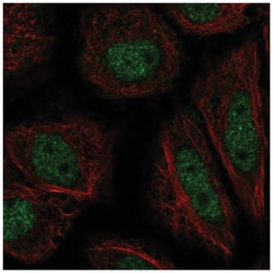 ZFY Antibody, Novus Biologicals 100 &mu;L | Buy Online | Novus Biologicals | Fisher Scientific