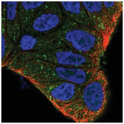 ZFYVE9 Antibody, Novus Biologicals 25 &mu;L, Unlabeled:Antibodies, Polyclonal